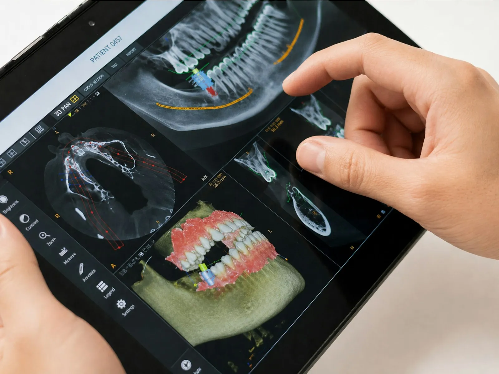 Operator working on 3D dental CAD software